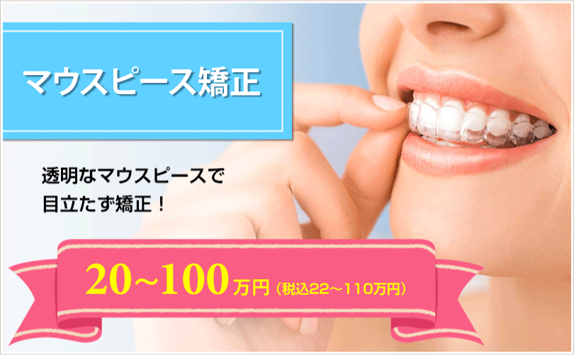 インビザライン（マウスピース矯正）透明なマウスピースで目立たず矯正！20~100万円（税込22~110万円）