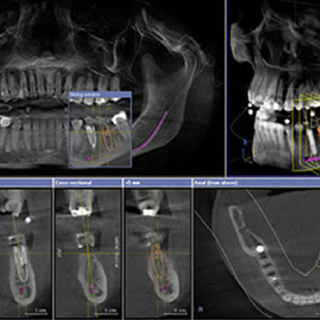 治療計画・お見積り
