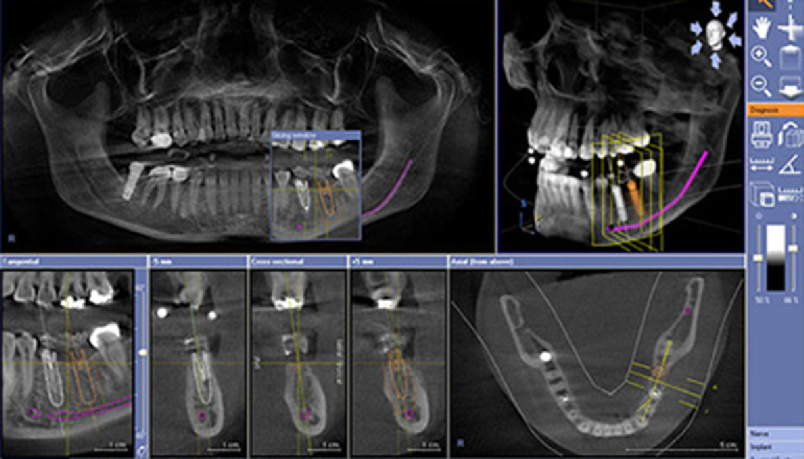 ●3Dシミュレーション